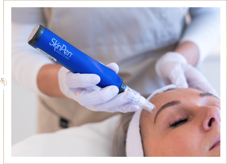 <h2>SkinPen, dat is nog meer resultaat dan klassieke microneedling</h2>
